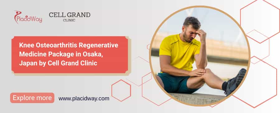 Stem Cell Therapy Japan: Knee Osteoarthritis Care in Osaka
