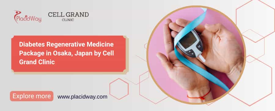 Diabetes Cure Japan: การดูแลเซลล์ต้นกำเนิดแบบฟื้นฟูในโอซาก้า