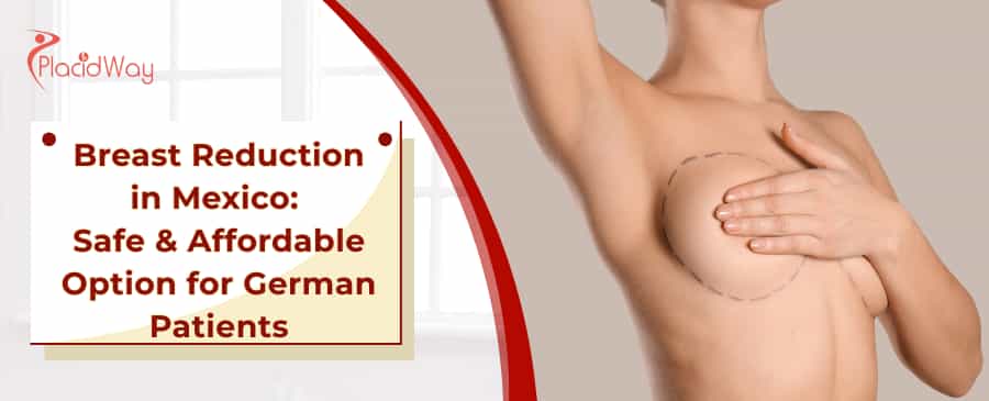 Breast Reduction Surgery in Mexico