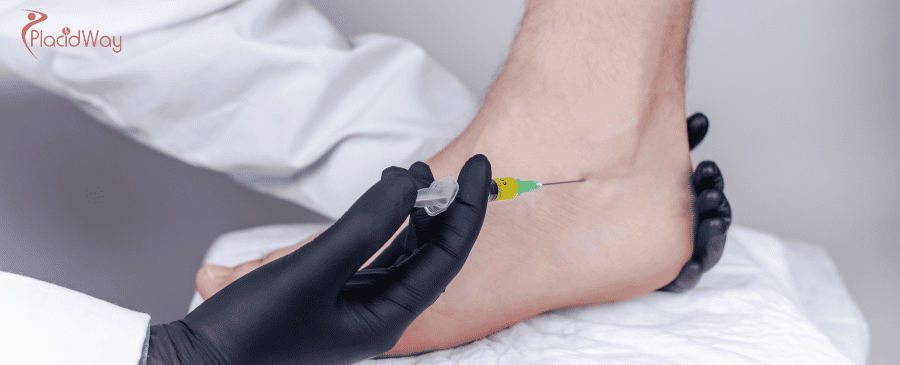 Achilles Tendon Repair Surgery in Mexico