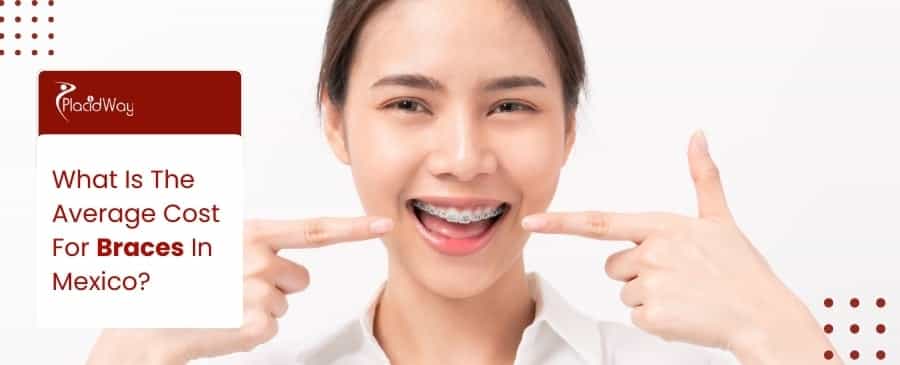 Braces In Mexico