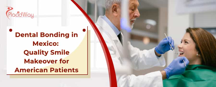 Affordable Dental Bonding in Mexico