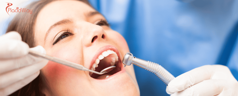 Affordable Dental Bonding in Mexico