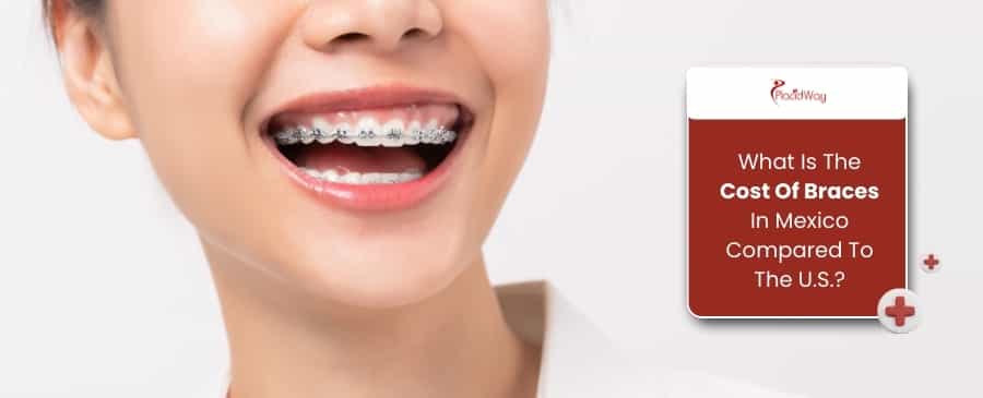 Brackets en México comparados con Estados Unidos