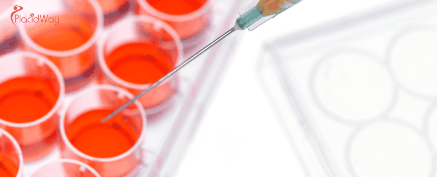 Stem Cell Cartilage Regeneration in Colombia