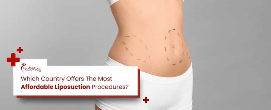 Liposucción asequible