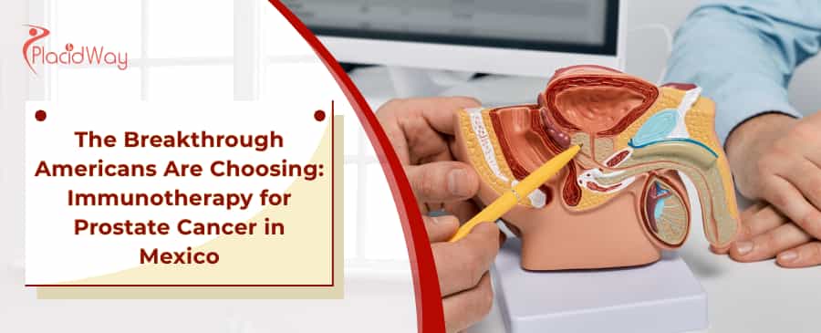 Immunotherapy for Prostate Cancer in Mexico