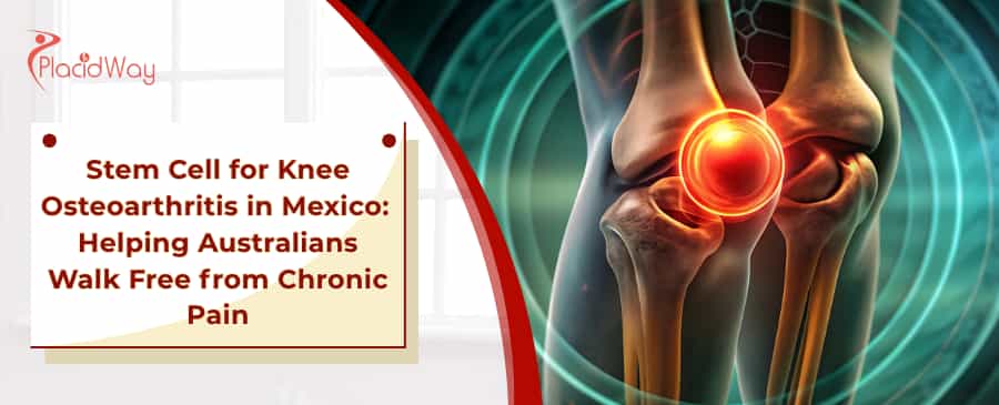 Terapia con células madre de rodilla en México