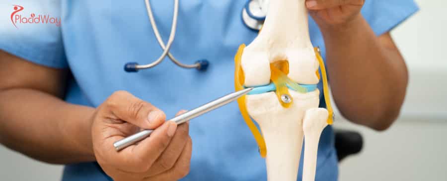 Terapia con células madre de rodilla en México