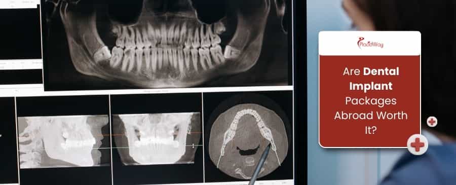 Dental Implant Packages