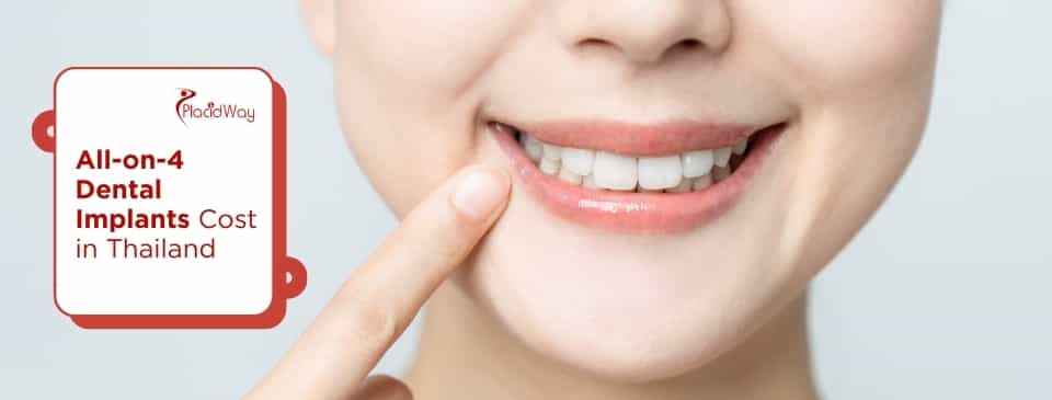 All-on-4 Dental Implants Cost