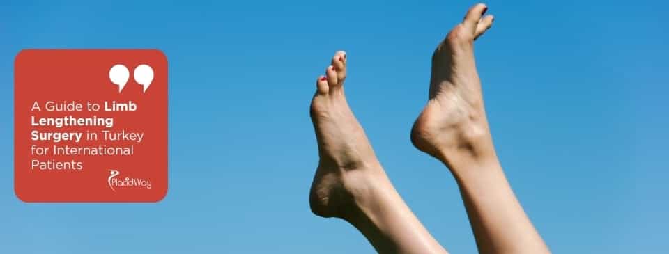 Limb Lengthening Surgery