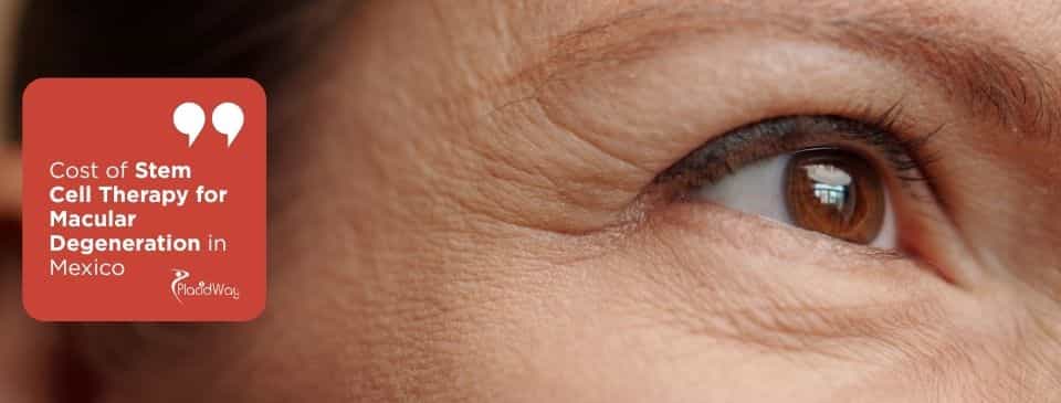 Stem Cell Therapy for Macular Degeneration