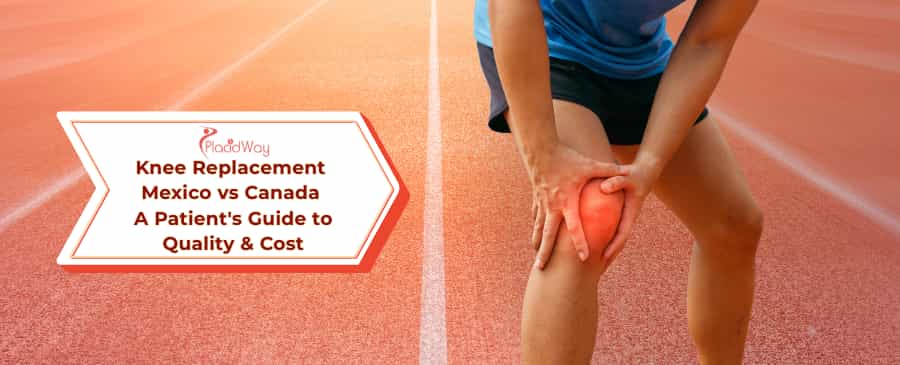 Knee Replacement Mexico vs Canada
