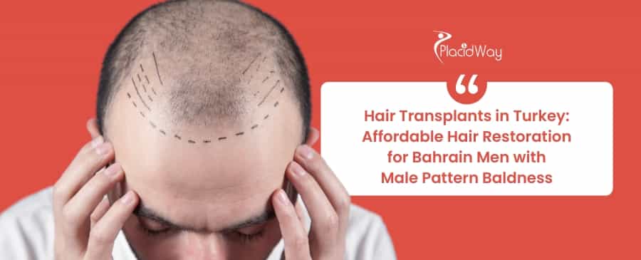 Hair Transplants in Turkey