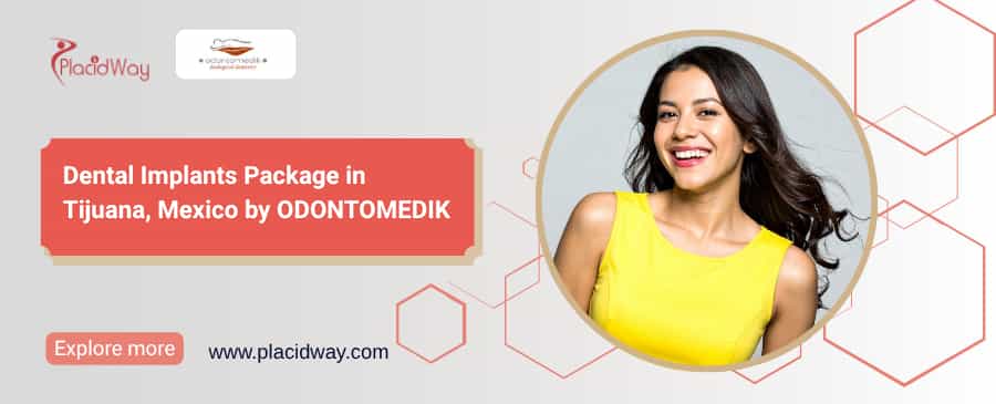 Dental Implants Tijuana Package | ODONTOMEDIK