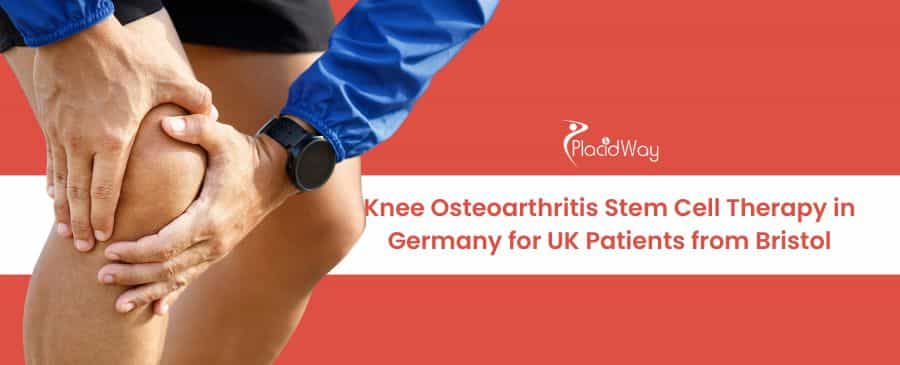 Knee Osteoarthritis Stem Cell Therapy in Germany