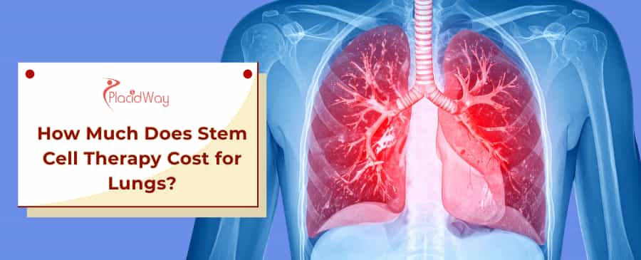 Stem Cell Therapy Cost for Lungs