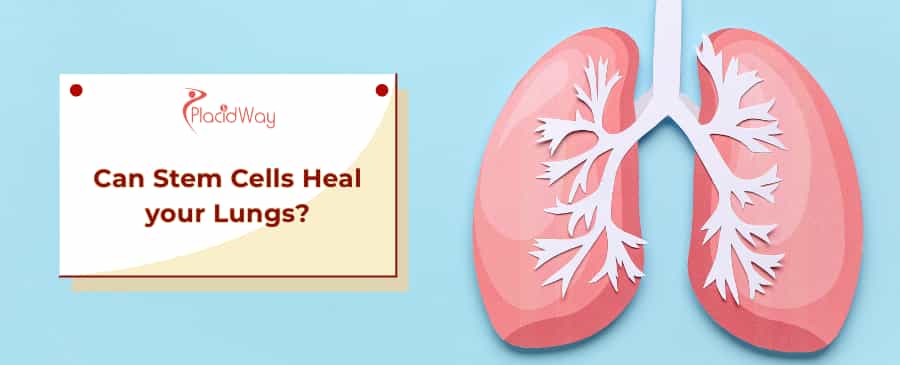 Stem Cells for Lungs