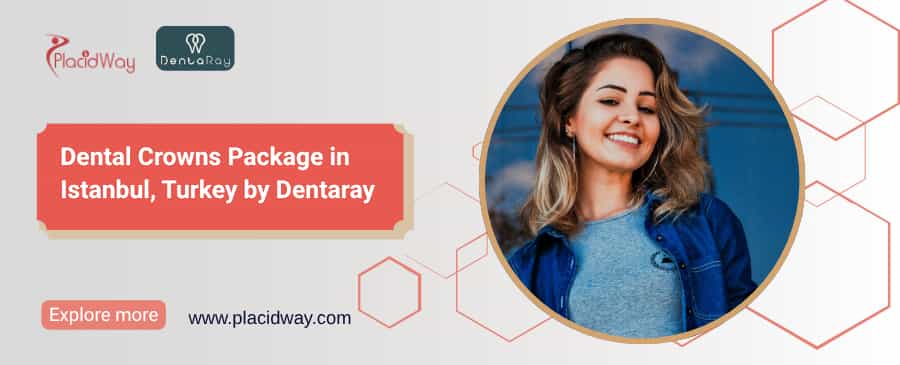 Dental Crowns in Istanbul | Dentaray Turkey $439