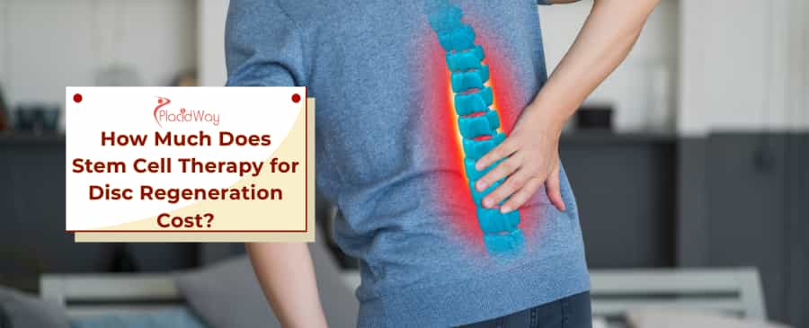 Stem Cell Therapy for Disc Regeneration