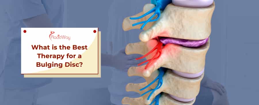 Best Therapy for Bulging Disc