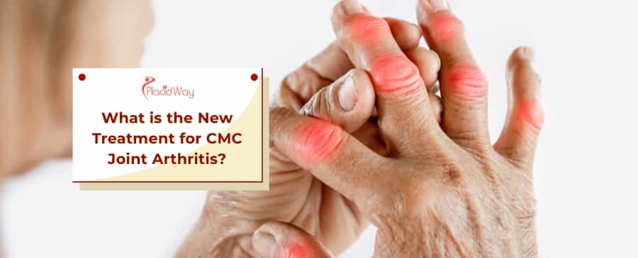 New Treatments for CMC Joint Arthritis
