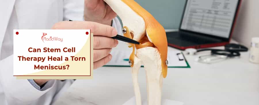 Stem Cell Therapy for Torn Meniscus