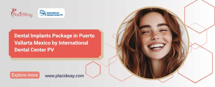 Affordable Dental Implants Puerto Vallarta | $600 Package
