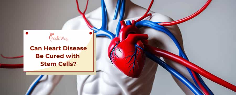 Stem Cells Cure Heart Disease