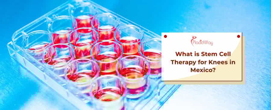 Stem Cell Therapy for Knees in Mexico