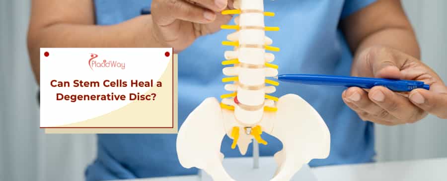 Stem Cells for Degenerative Disc Disease