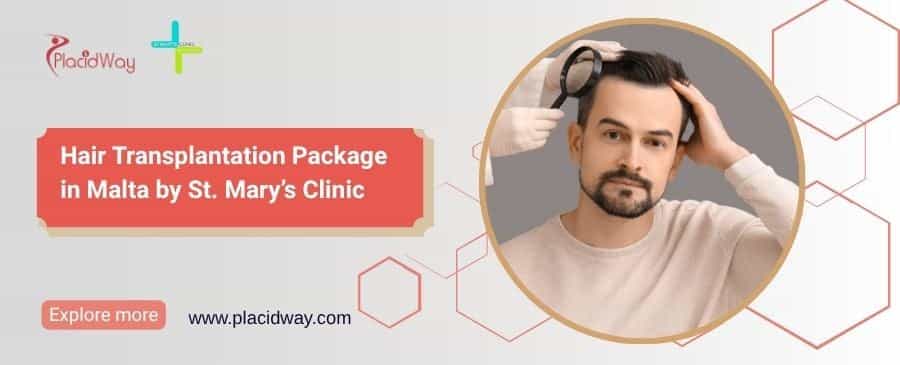 Hair Transplant in Malta | St. Mary’s Clinic Package €5,000