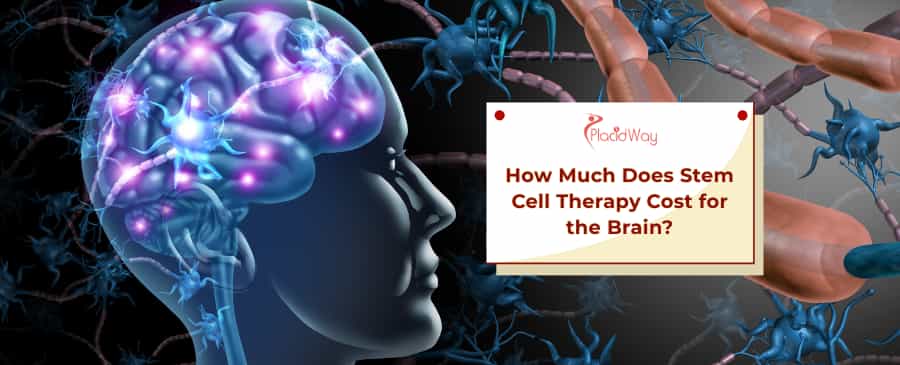 Stem Cell Therapy Cost for Brain 