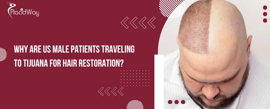 Tijuana for Hair Restoration