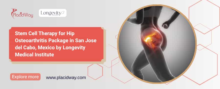 Stem Cell Injections in Mexico for Hip Osteoarthritis