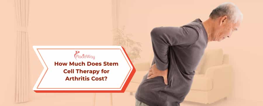 Stem Cell Therapy for Arthritis Cost