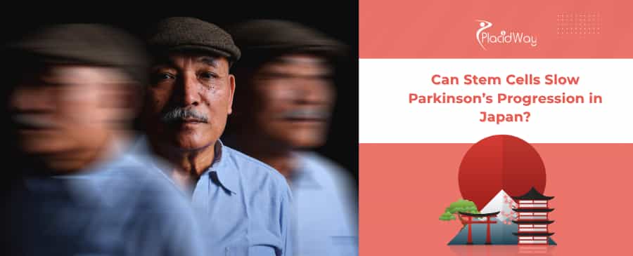 Stem Cell Therapy for Parkinson’s in Japan