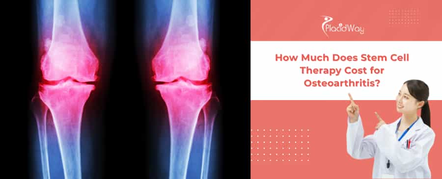 Stem Cell Therapy Cost for Osteoarthritis