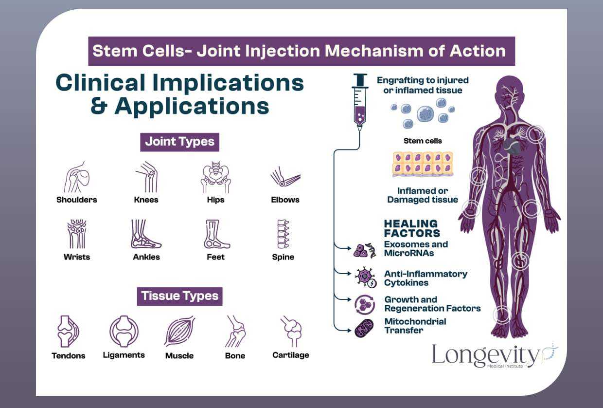 Stem Cell Treatment for Joints in Mexico