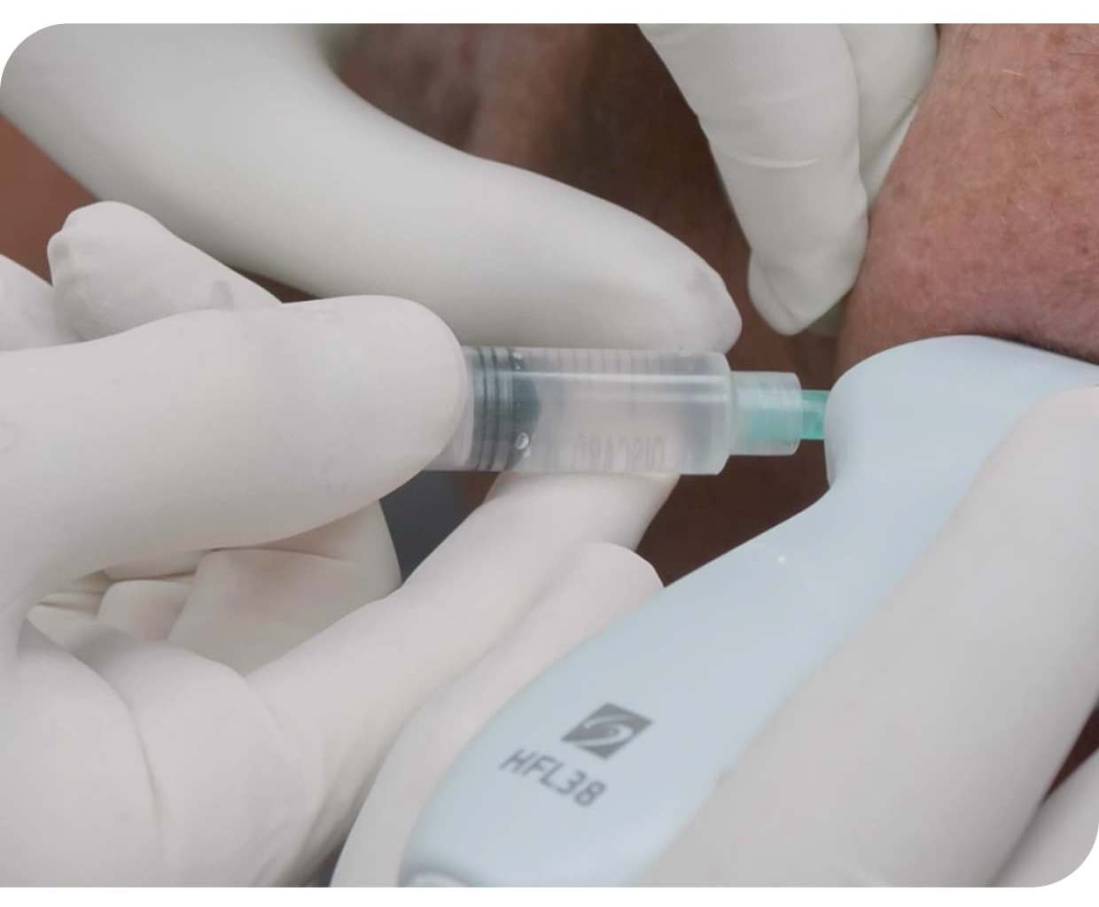 Stem Cell Therapy for Joint Pain in San Jose Del Cabo Mexico