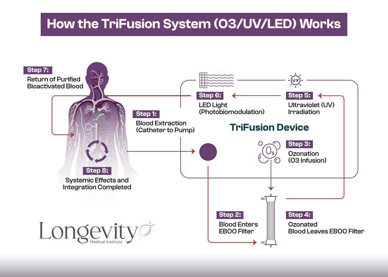 IV Ozone Therapy in Mexico