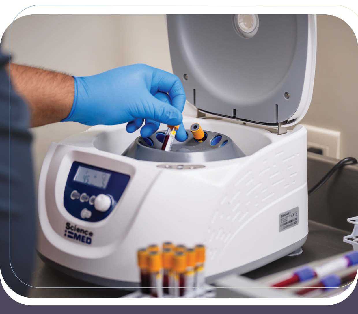 Stem Cell Treatments Mexico