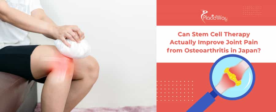 Stem Cell Therapy for Osteoarthritis in Japan