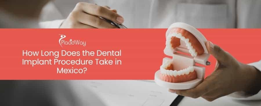 How long does the dental implant procedure take in Mexico?