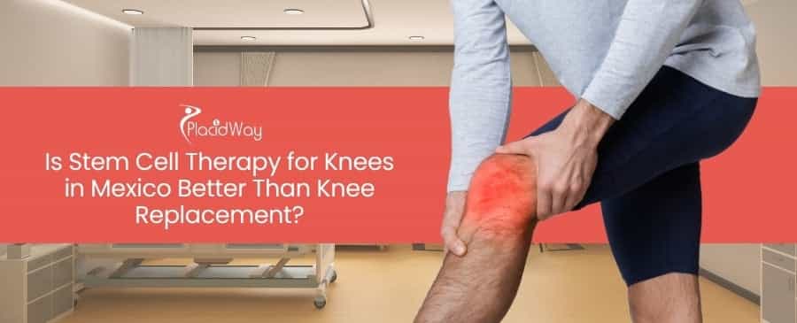 Stem Cell Therapy for Knees in Mexico
