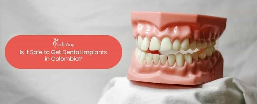 Dental Implants in Colombia