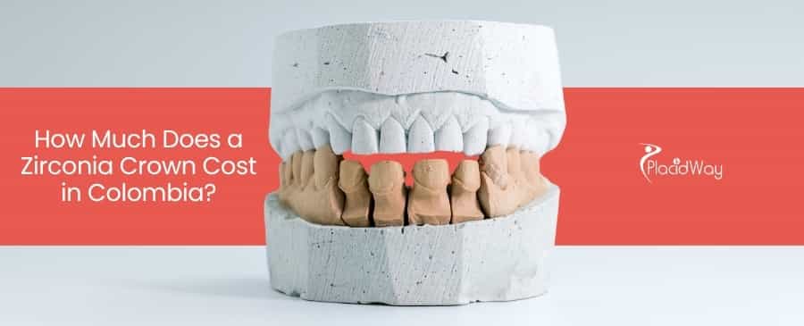 Zirconia Crown Cost in Colombia