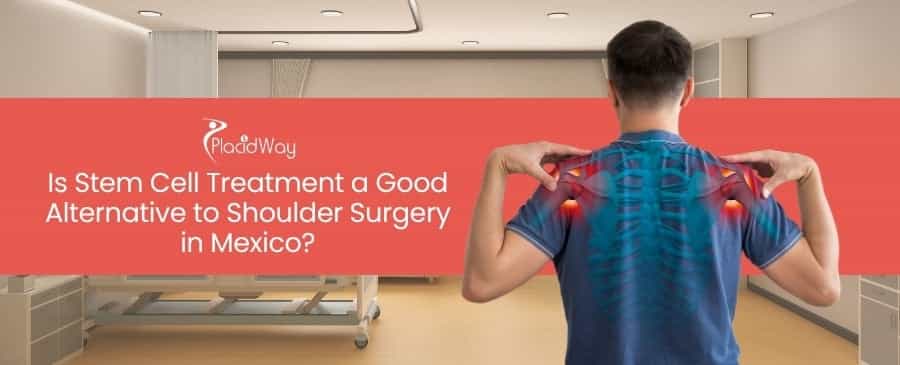 Stem Cell Treatment for Shoulder Surgery in Mexico
