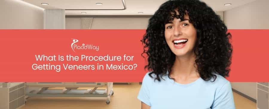 Veneers in Mexico